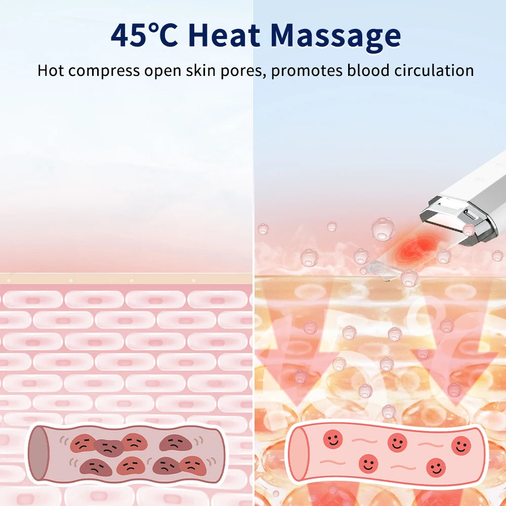 ANLAN Ultrasonic Skin Scrubber – 5-in-1 Facial Lifting Device with EMS, ION, Sonic & 45°C Heat