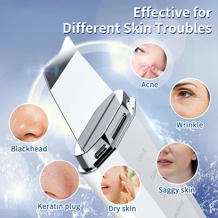 ANLAN Ultrasonic Skin Scrubber – 5-in-1 Facial Lifting Device with EMS, ION, Sonic & 45°C Heat